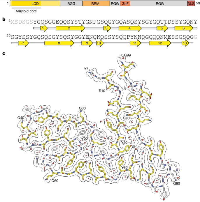Nature：科學(xué)家識(shí)別出與人類額顳葉癡呆癥發(fā)生相關(guān)的新型蛋白質(zhì)