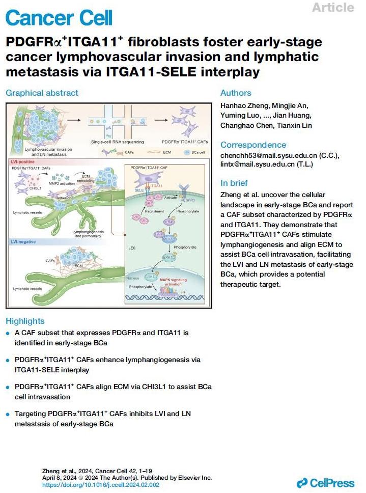 研究揭示早期膀胱癌脈管癌栓形成的關(guān)鍵分子機(jī)制 研究揭示早期膀胱癌脈管癌栓形成的關(guān)鍵分子機(jī)制